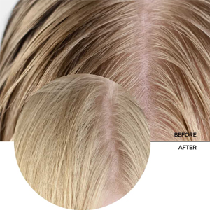 REVOX B77 Очищающая сыворотка для кожи головы JUST SALICYLIC ACID REVOX B77, 30 мл